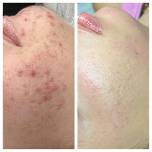 Client Testimonials at Healthy Glow Aesthetics in Fort Lauderdale