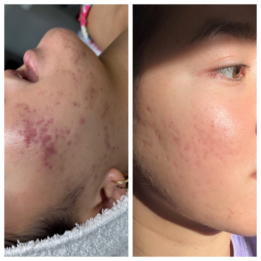 Client Testimonials – Fort Lauderdale, FL med spa